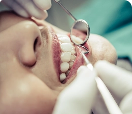 زراعة الأسنان والتجميل السني