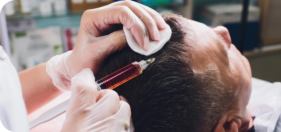 كيف بتتم زراعة الشعر في داماس فيو؟